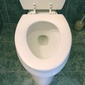 How to Get Brown Rings & Stains Out of a Toilet Bowl | Hunker