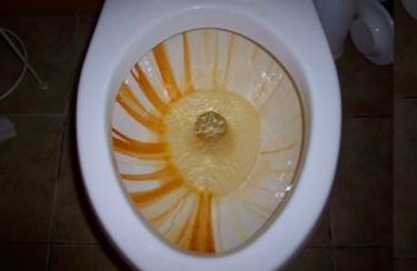 Stained toilet bowl.