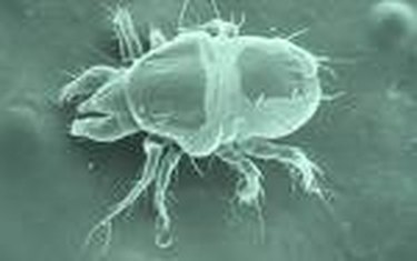 How Does a Dust Mite Infestation Occur? | Hunker