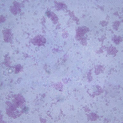 Microscopic Image of Escherichia Coli