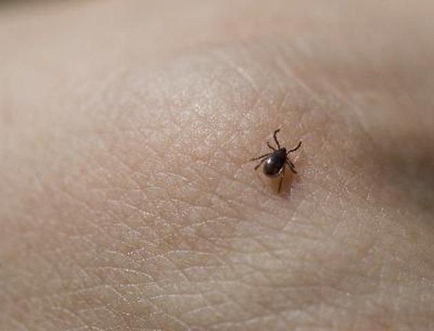 Tick crawling on human skin.