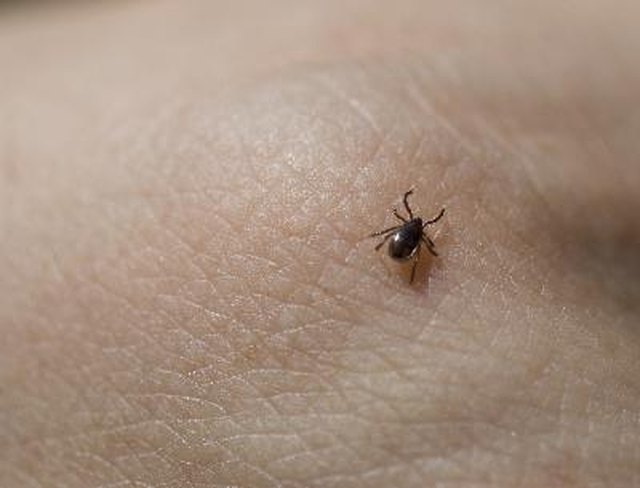 Tick crawling on human skin.
