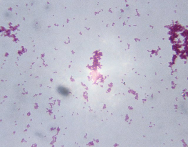 Microscopic Image of Neisseria Gonorrhoeae