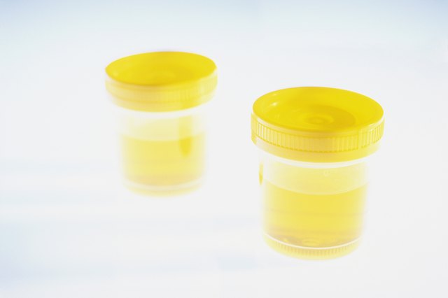 Two Urine Samples